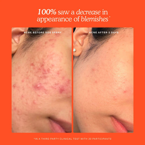 SOS Skincare Minis Kit