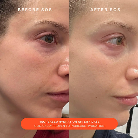 SOS Recovery Cream