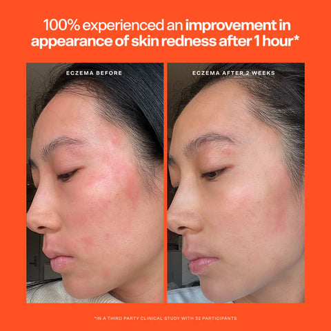 SOS Rescue Serum